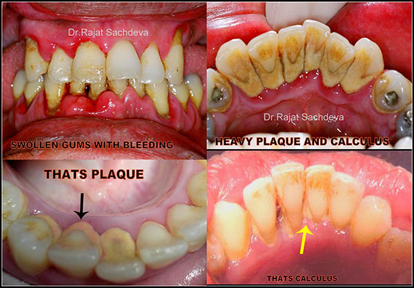 Dental Courses In Delhi,cosmetic dental surgery in delhi ,cosmetic dentist in delhi,Dental Implants Clinic in Delhi,cosmetic dentist delhi,dentist in delhi,dental implant courses in delhi,cost of tooth implant in delhi,tooth implant cost in delhi,cosmetic dentistry in delhi,dental clinic in delhi,laser dentistry courses in delhi,cosmetic dental surgery Delhi